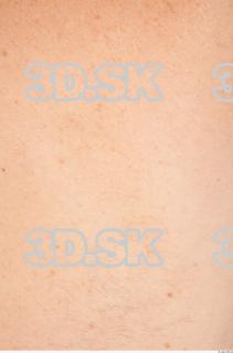 Skin texture of Vendelin 0001